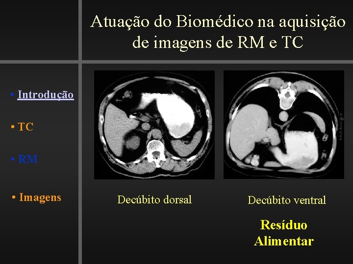 Atuação do Biomédico na aquisição de imagens de RM e TC • Introdução •