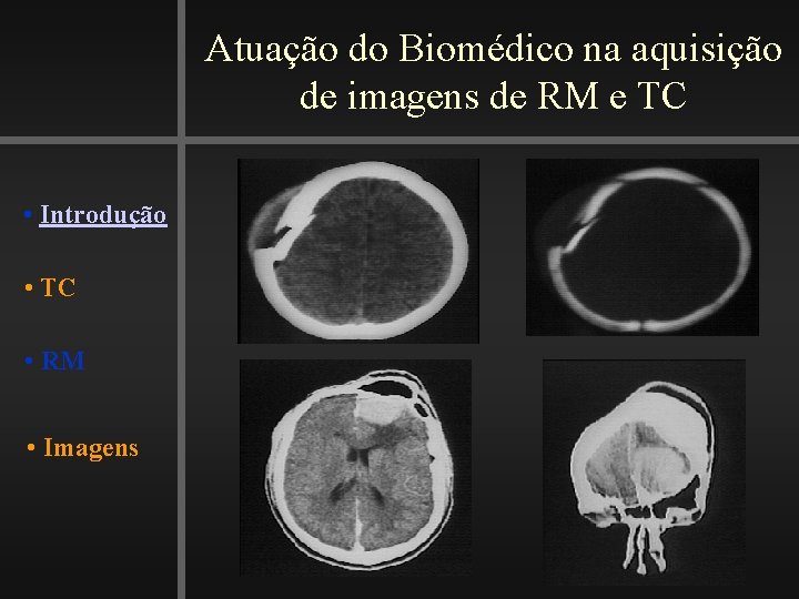 Atuação do Biomédico na aquisição de imagens de RM e TC • Introdução •