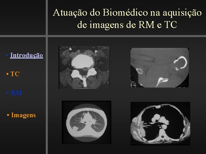 Atuação do Biomédico na aquisição de imagens de RM e TC • Introdução •