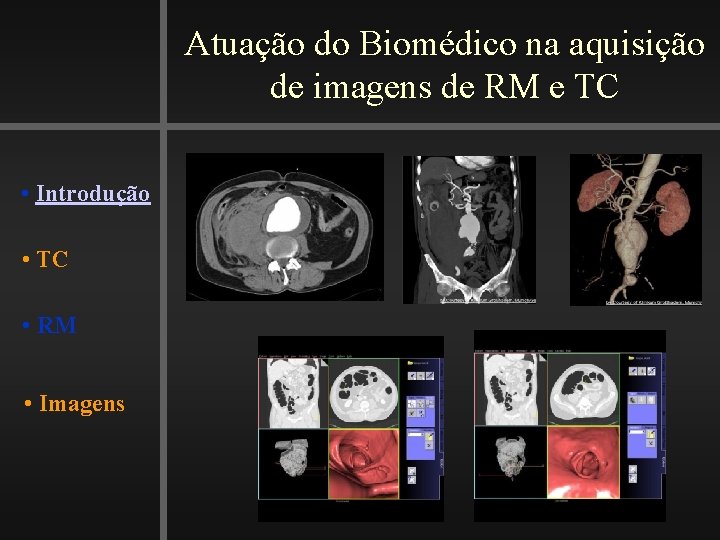 Atuação do Biomédico na aquisição de imagens de RM e TC • Introdução •