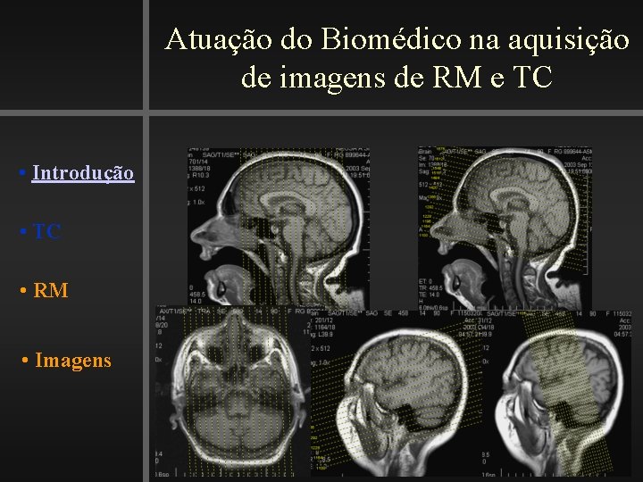 Atuação do Biomédico na aquisição de imagens de RM e TC • Introdução •