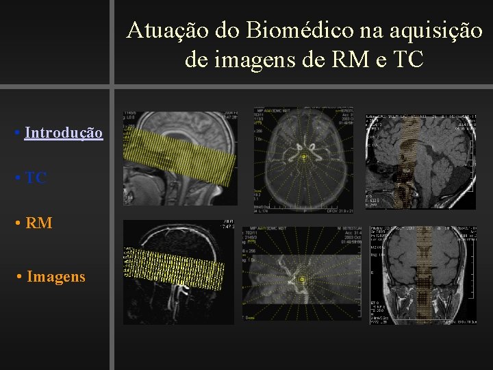 Atuação do Biomédico na aquisição de imagens de RM e TC • Introdução •