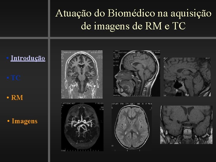 Atuação do Biomédico na aquisição de imagens de RM e TC • Introdução •