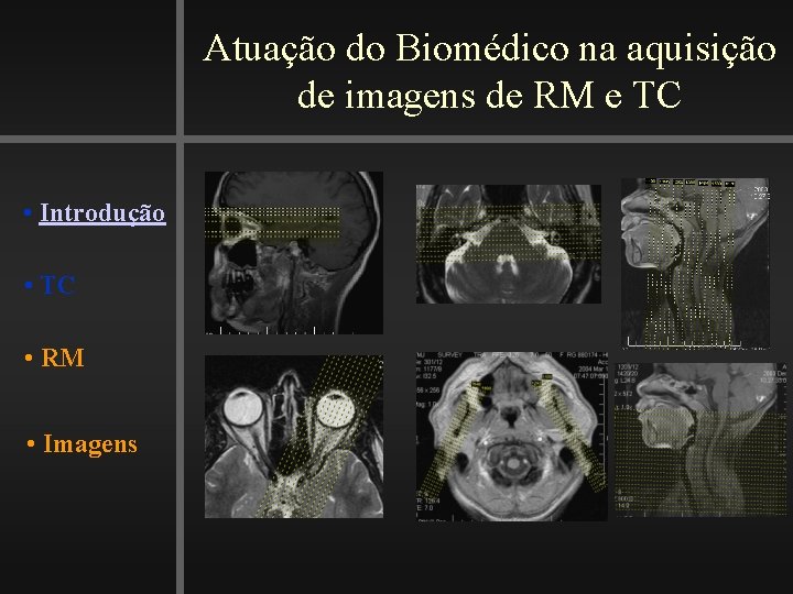 Atuação do Biomédico na aquisição de imagens de RM e TC • Introdução •