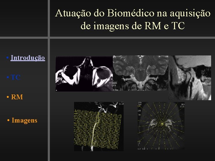 Atuação do Biomédico na aquisição de imagens de RM e TC • Introdução •