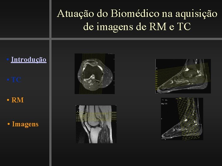 Atuação do Biomédico na aquisição de imagens de RM e TC • Introdução •