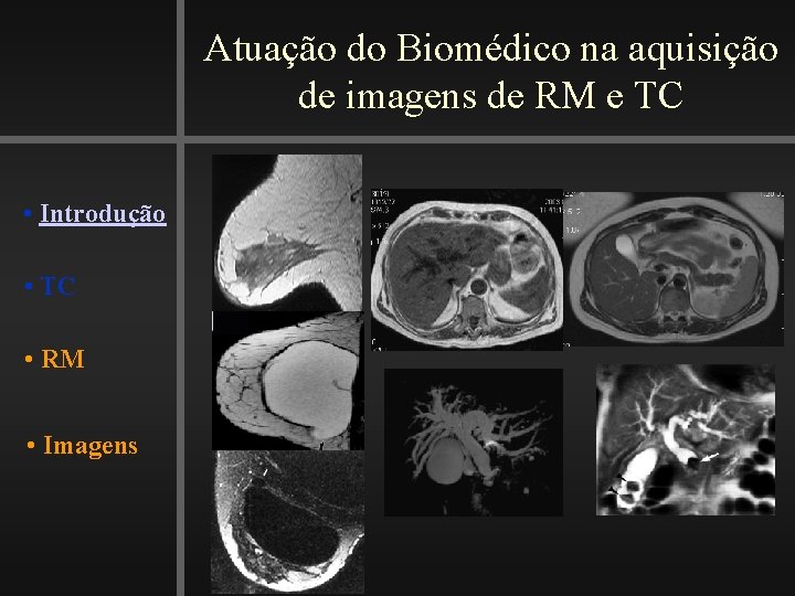 Atuação do Biomédico na aquisição de imagens de RM e TC • Introdução •