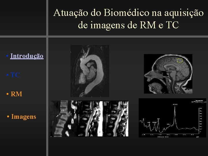 Atuação do Biomédico na aquisição de imagens de RM e TC • Introdução •