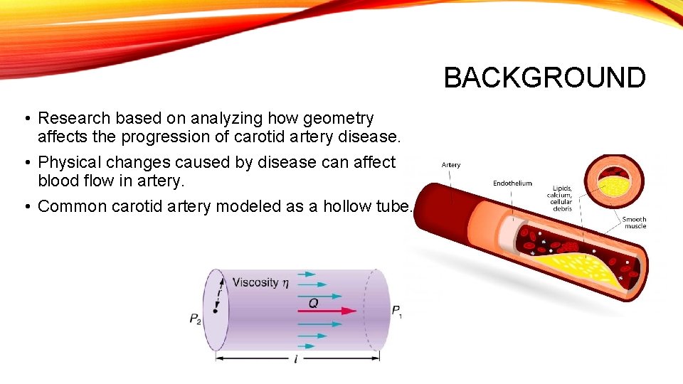 BACKGROUND • Research based on analyzing how geometry affects the progression of carotid artery