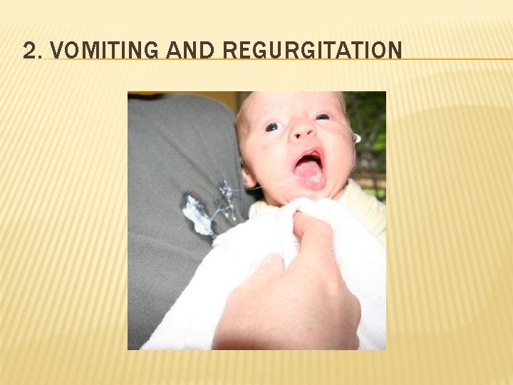 2. VOMITING AND REGURGITATION 