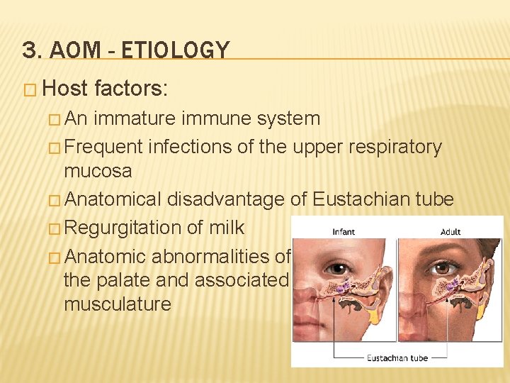 3. AOM - ETIOLOGY � Host � An factors: immature immune system � Frequent