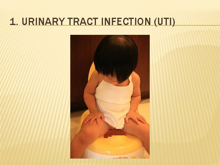 1. URINARY TRACT INFECTION (UTI) 