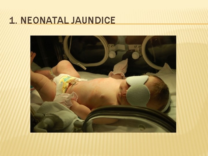 1. NEONATAL JAUNDICE 