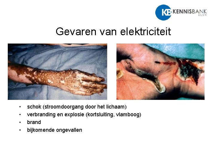 Gevaren van elektriciteit • • schok (stroomdoorgang door het lichaam) verbranding en explosie (kortsluiting,