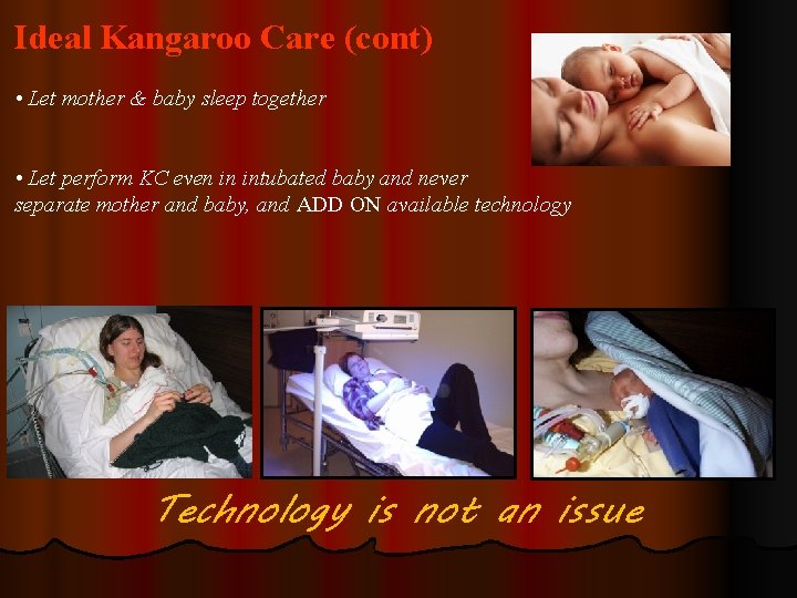 Ideal Kangaroo Care (cont) • Let mother & baby sleep together • Let perform