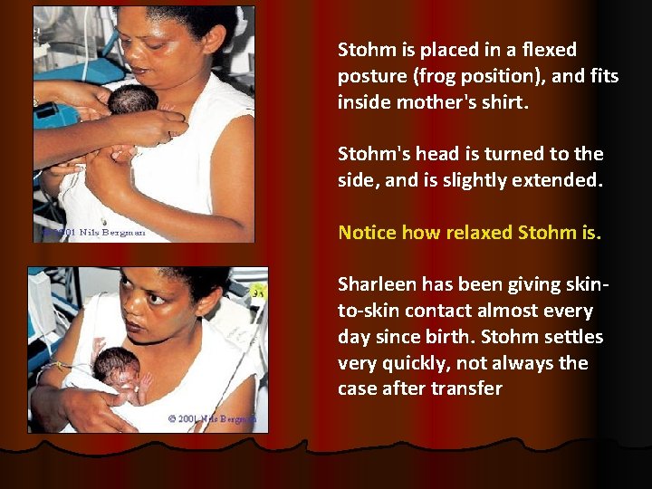 Stohm is placed in a flexed posture (frog position), and fits inside mother's shirt.