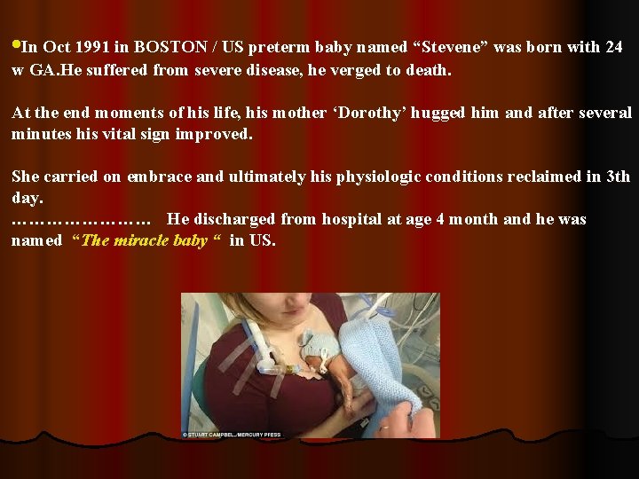  • In Oct 1991 in BOSTON / US preterm baby named “Stevene” was