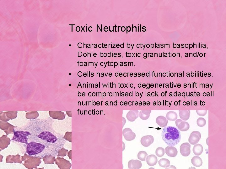 Toxic Neutrophils • Characterized by ctyoplasm basophilia, Dohle bodies, toxic granulation, and/or foamy cytoplasm.