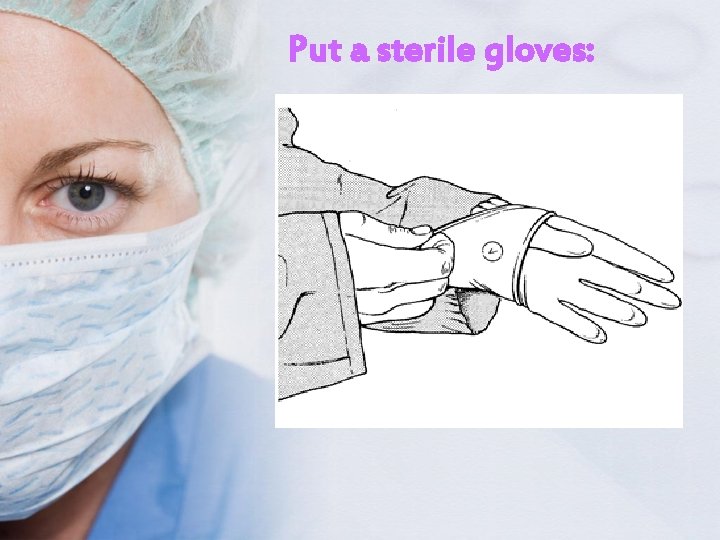 Put a sterile gloves: 