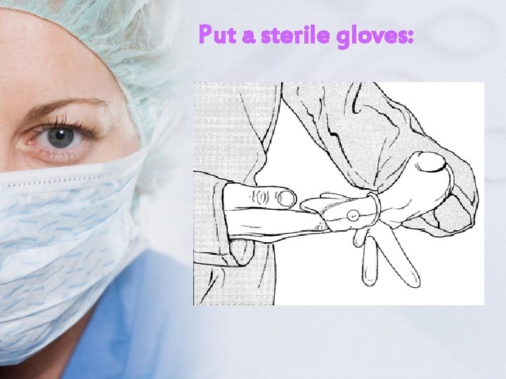 Put a sterile gloves: 