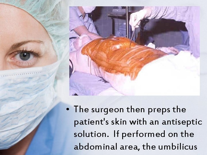  • The surgeon then preps the patient's skin with an antiseptic solution. If