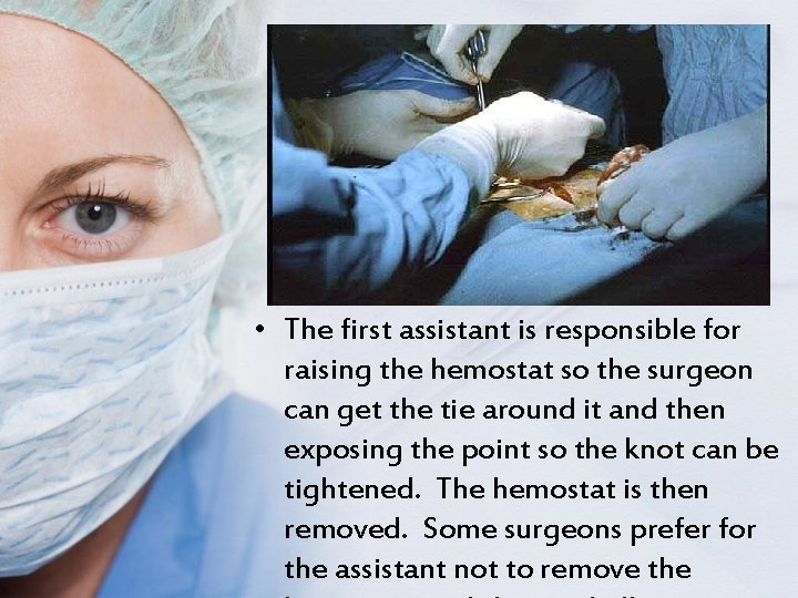  • The first assistant is responsible for raising the hemostat so the surgeon