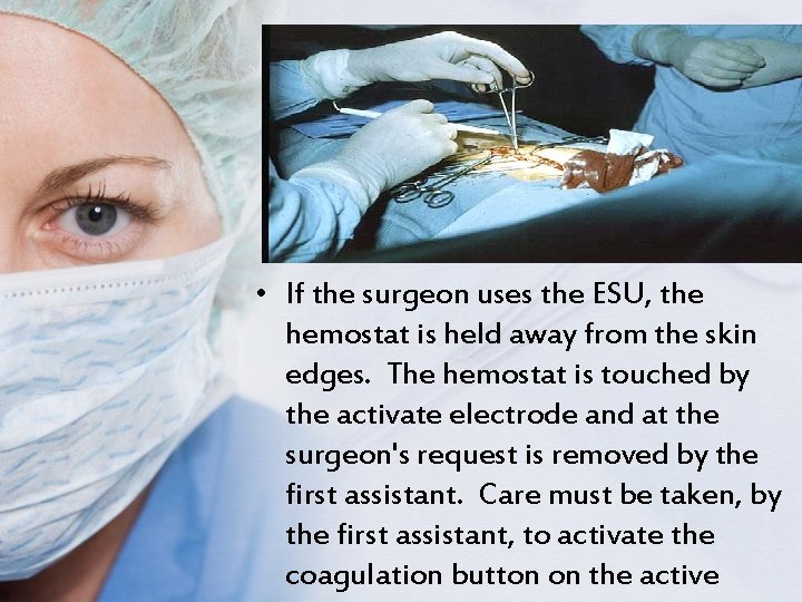  • If the surgeon uses the ESU, the hemostat is held away from