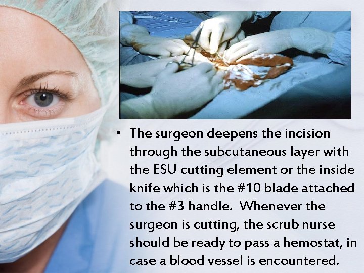  • The surgeon deepens the incision through the subcutaneous layer with the ESU