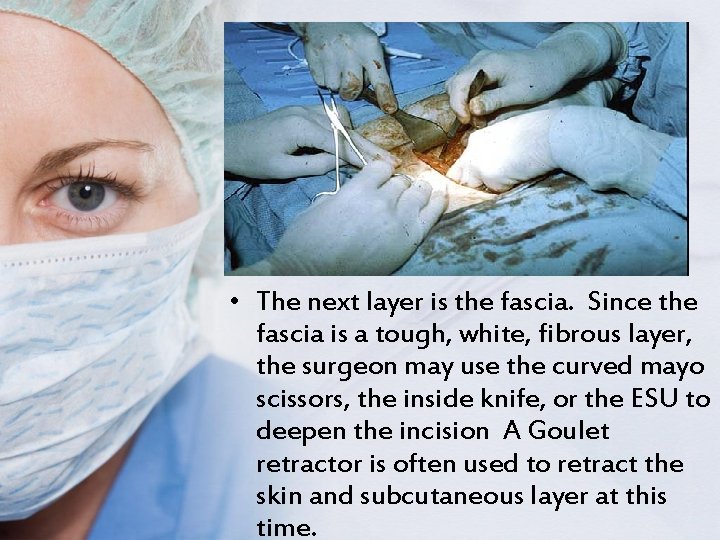  • The next layer is the fascia. Since the fascia is a tough,