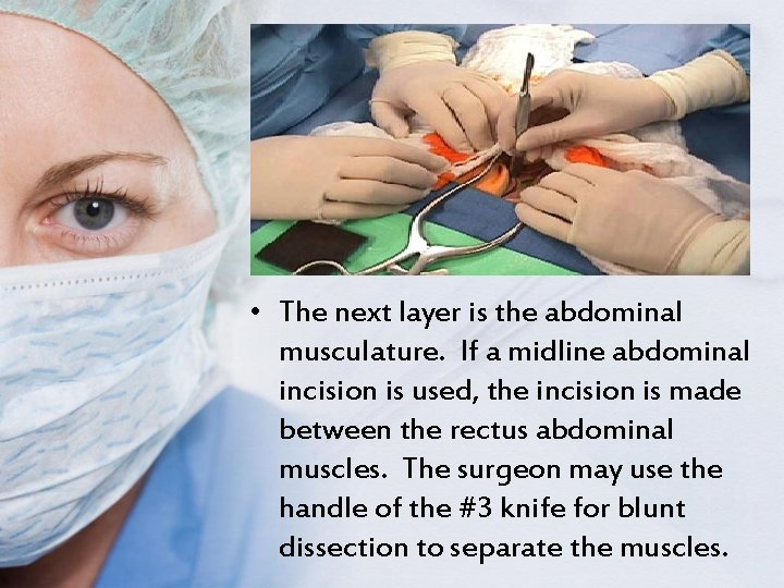  • The next layer is the abdominal musculature. If a midline abdominal incision