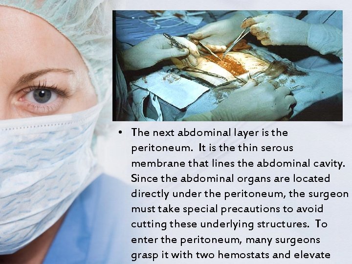  • The next abdominal layer is the peritoneum. It is the thin serous