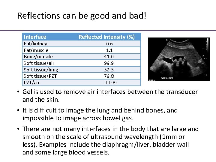 Reflections can be good and bad! Interface Fat/kidney Fat/muscle Bone/muscle Soft tissue/air Soft tissue/lung