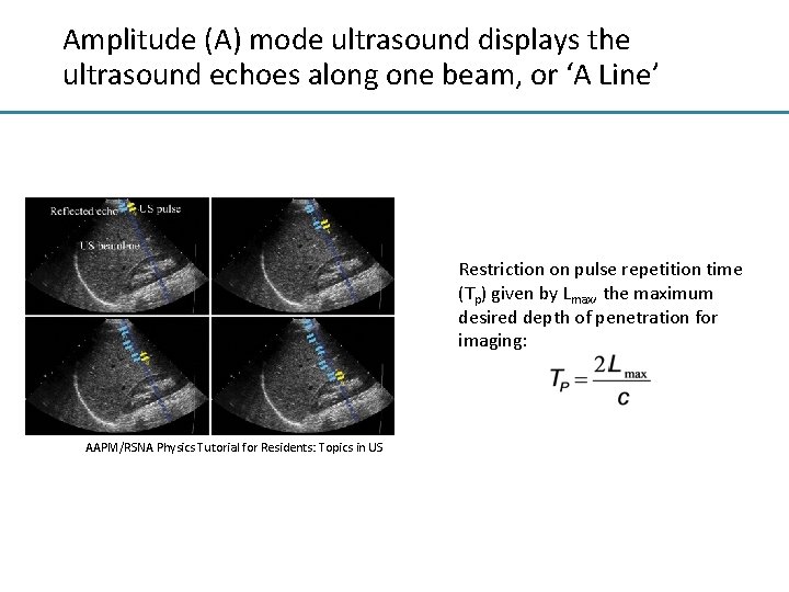 Amplitude (A) mode ultrasound displays the ultrasound echoes along one beam, or ‘A Line’