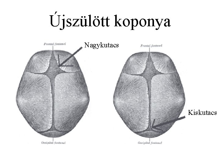 Újszülött koponya Nagykutacs Kiskutacs 