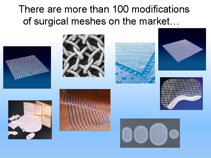 There are more than 100 modifications of surgical meshes on the market… 