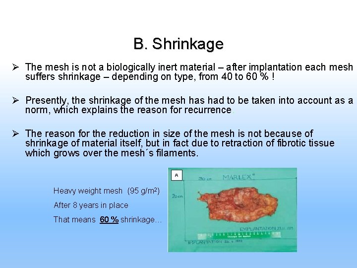 B. Shrinkage Ø The mesh is not a biologically inert material – after implantation