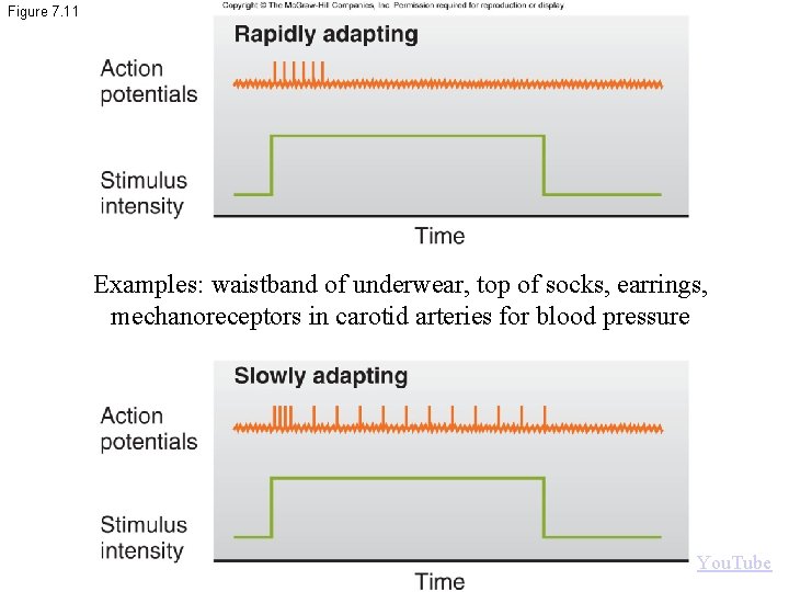 Figure 7. 11 Examples: waistband of underwear, top of socks, earrings, mechanoreceptors in carotid