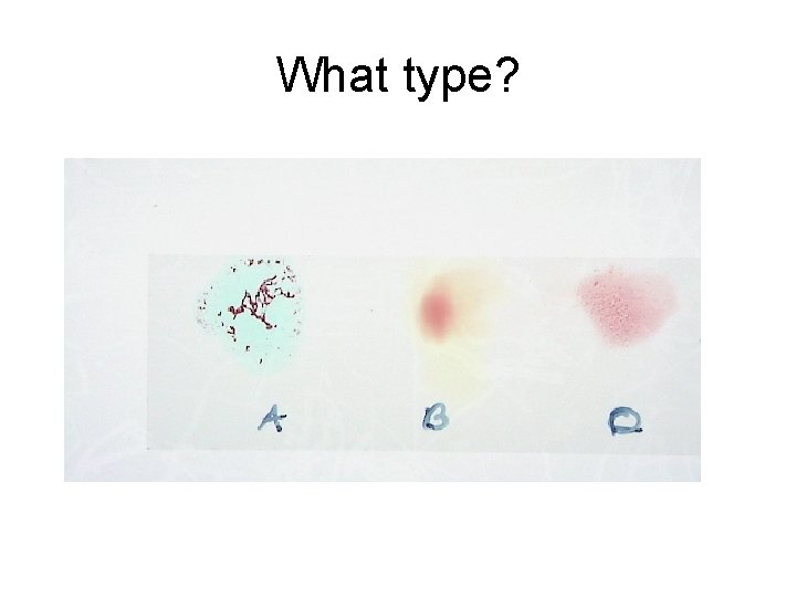 What type? 