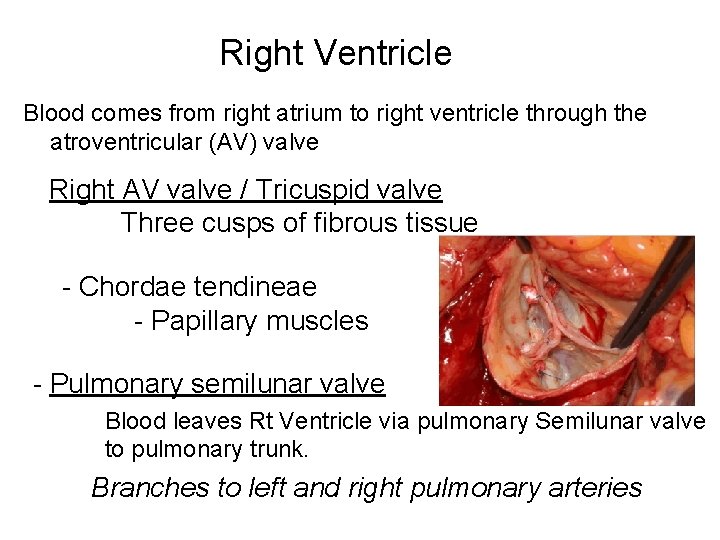 Right Ventricle Blood comes from right atrium to right ventricle through the atroventricular (AV)
