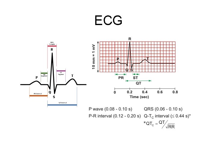ECG 