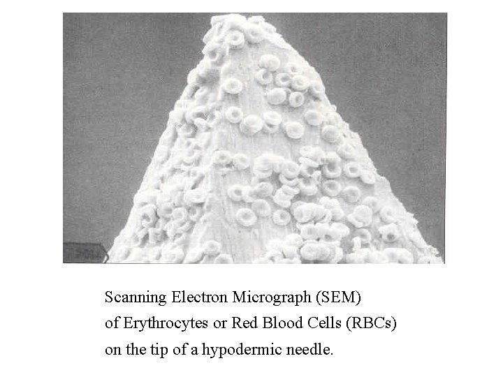 Scanning Electron Micrograph (SEM) of Erythrocytes or Red Blood Cells (RBCs) on the tip