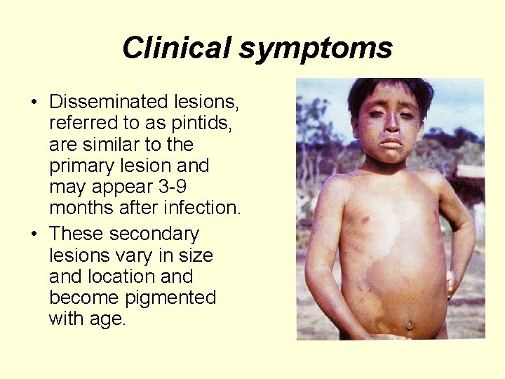 Clinical symptoms • Disseminated lesions, referred to as pintids, are similar to the primary
