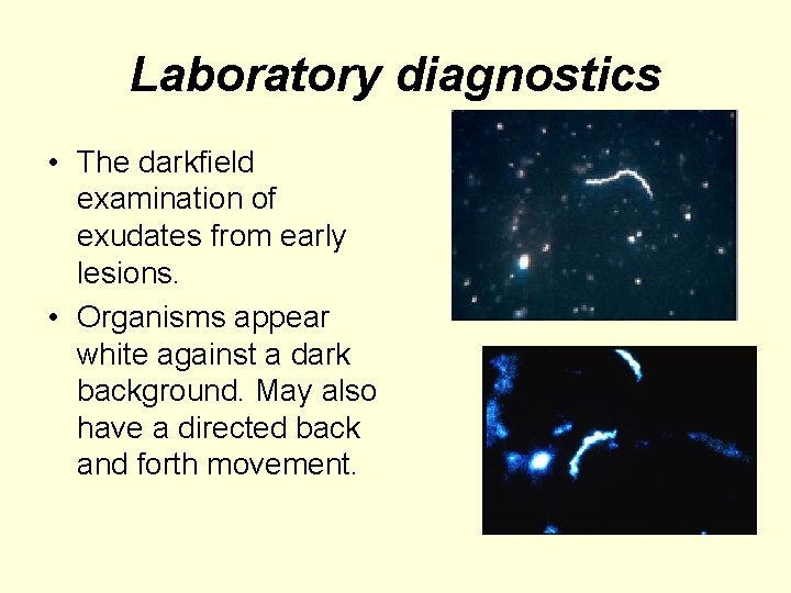 Laboratory diagnostics • The darkfield examination of exudates from early lesions. • Organisms appear