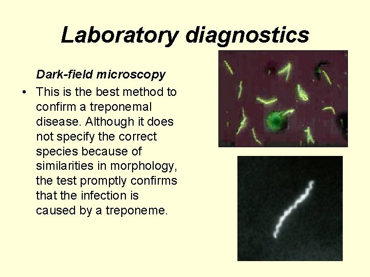 Laboratory diagnostics Dark-field microscopy • This is the best method to confirm a treponemal