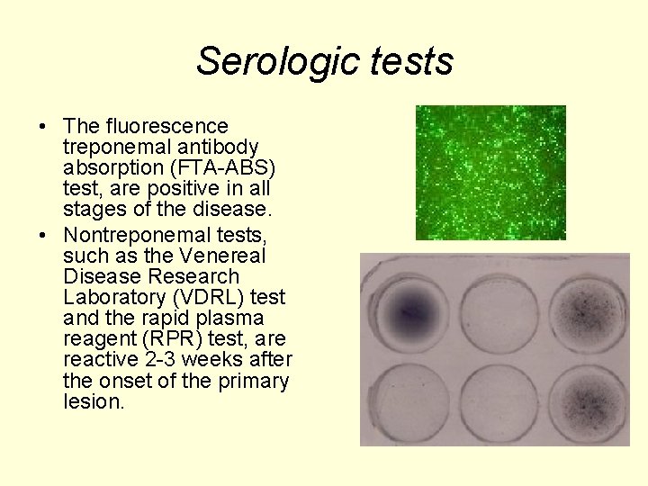 Serologic tests • The fluorescence treponemal antibody absorption (FTA-ABS) test, are positive in all