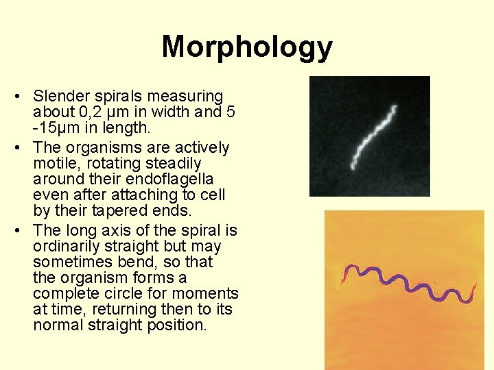 Morphology • Slender spirals measuring about 0, 2 µm in width and 5 -15µm