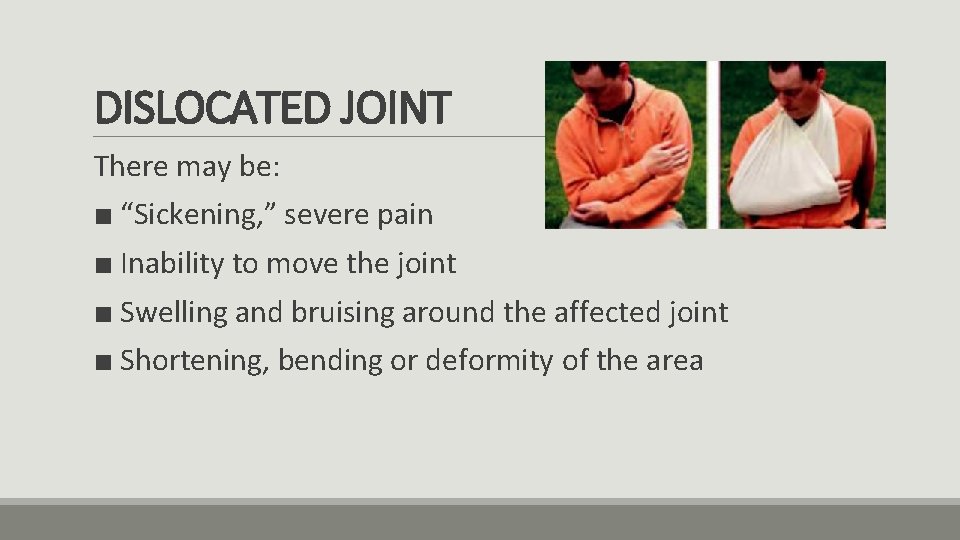 DISLOCATED JOINT There may be: ■ “Sickening, ” severe pain ■ Inability to move