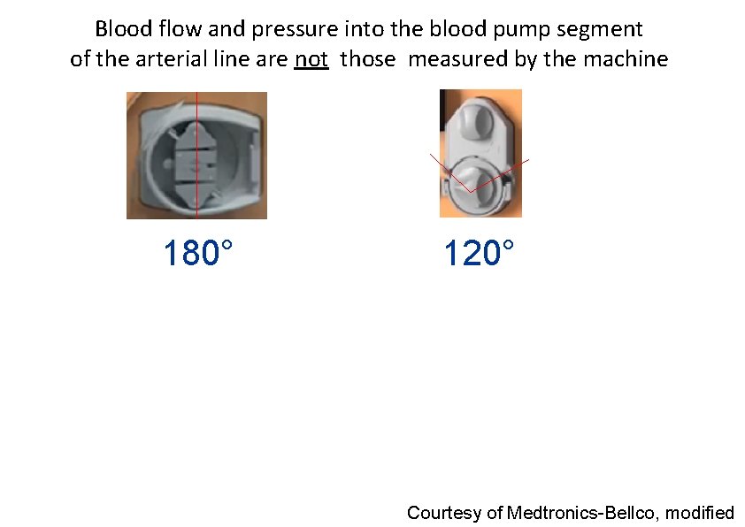 Blood flow and pressure into the blood pump segment of the arterial line are