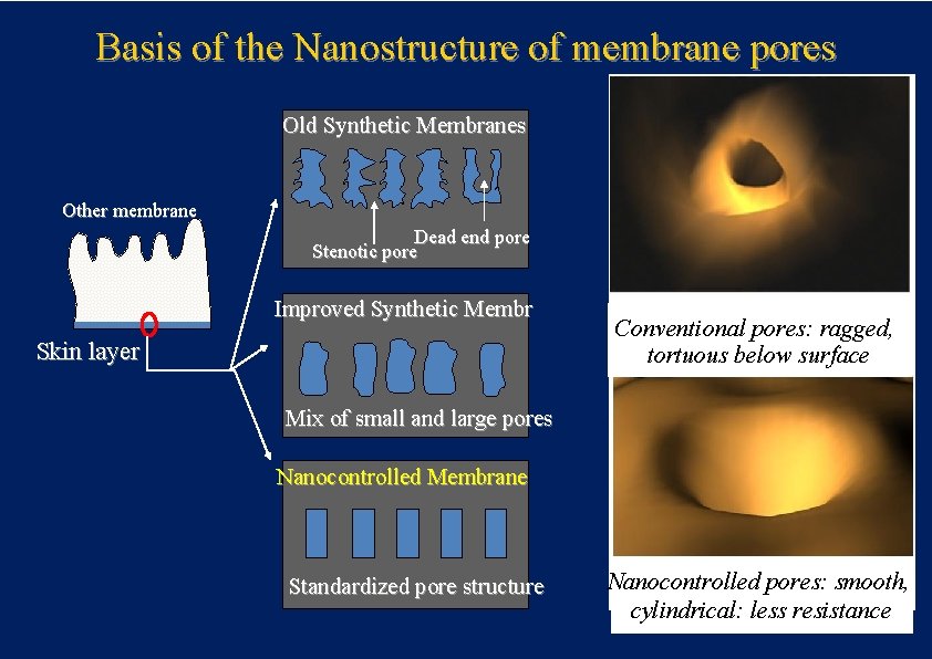 Basis of the Nanostructure of membrane pores Old Synthetic Membranes Other membrane Dead end