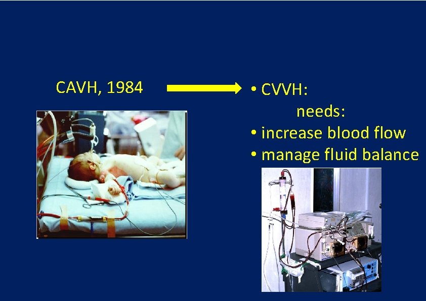 CAVH, 1984 • CVVH: needs: • increase blood flow • manage fluid balance 